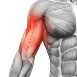 بازوبند ای ام اس جهت تقویت عضلات بازو